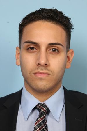 Rhinoplasty: Patient 3 - After Image 1