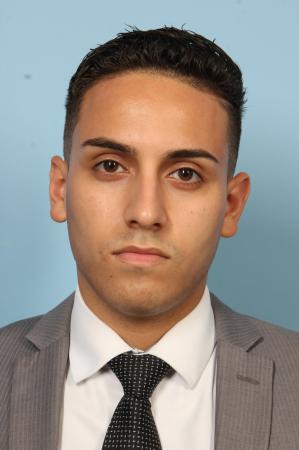 Rhinoplasty: Patient 3 - Before Image 1
