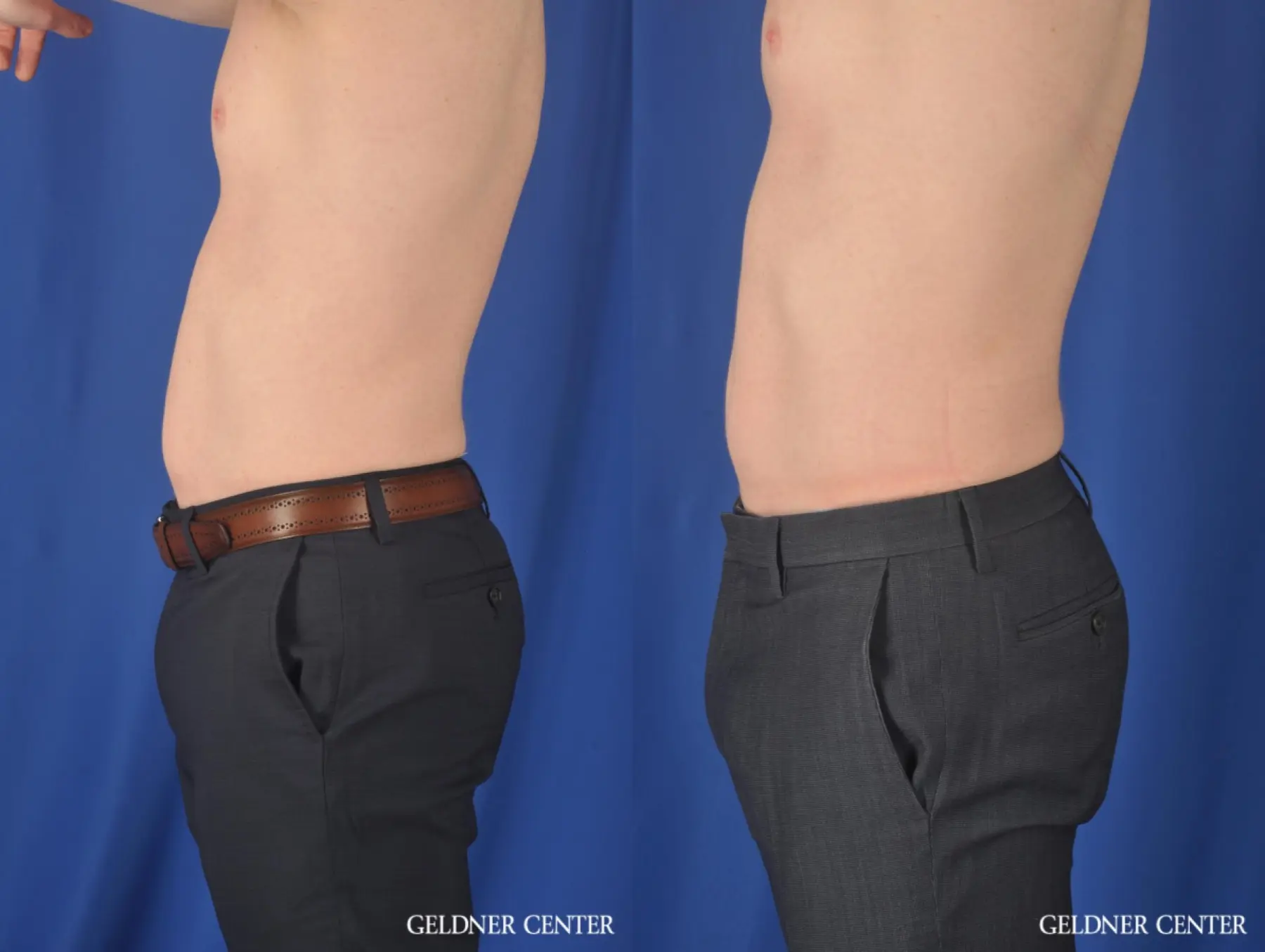 Men's glutes before and after best sale