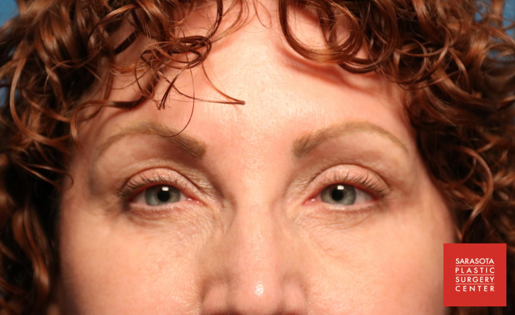 Permanent Makeup - Eyebrows: Patient 11 - After 