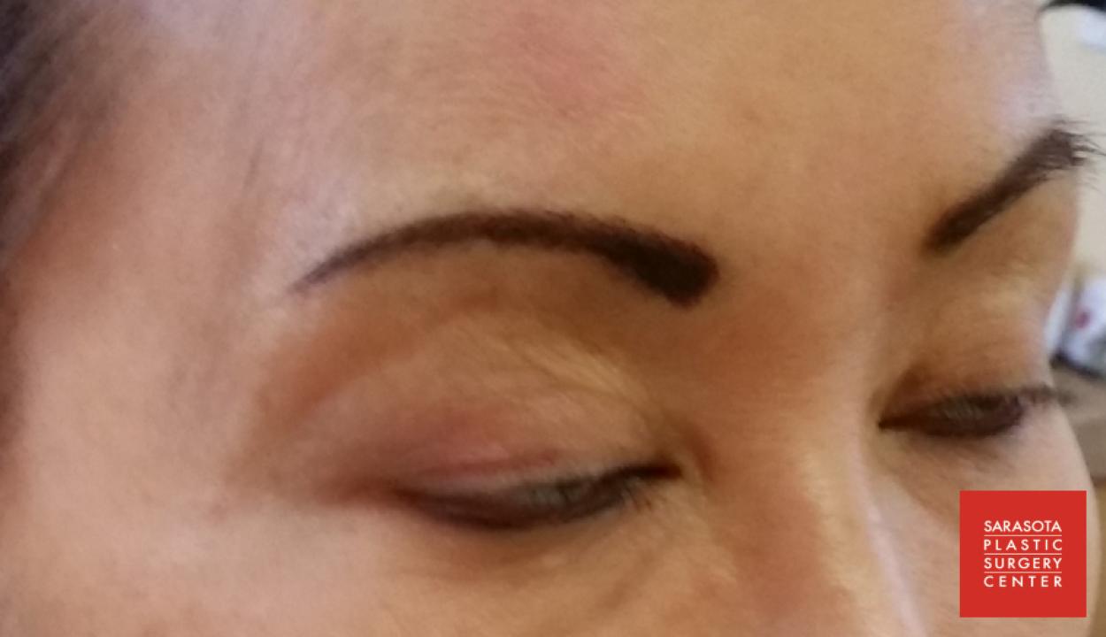 Permanent Makeup - Eyebrows: Patient 8 - After  
