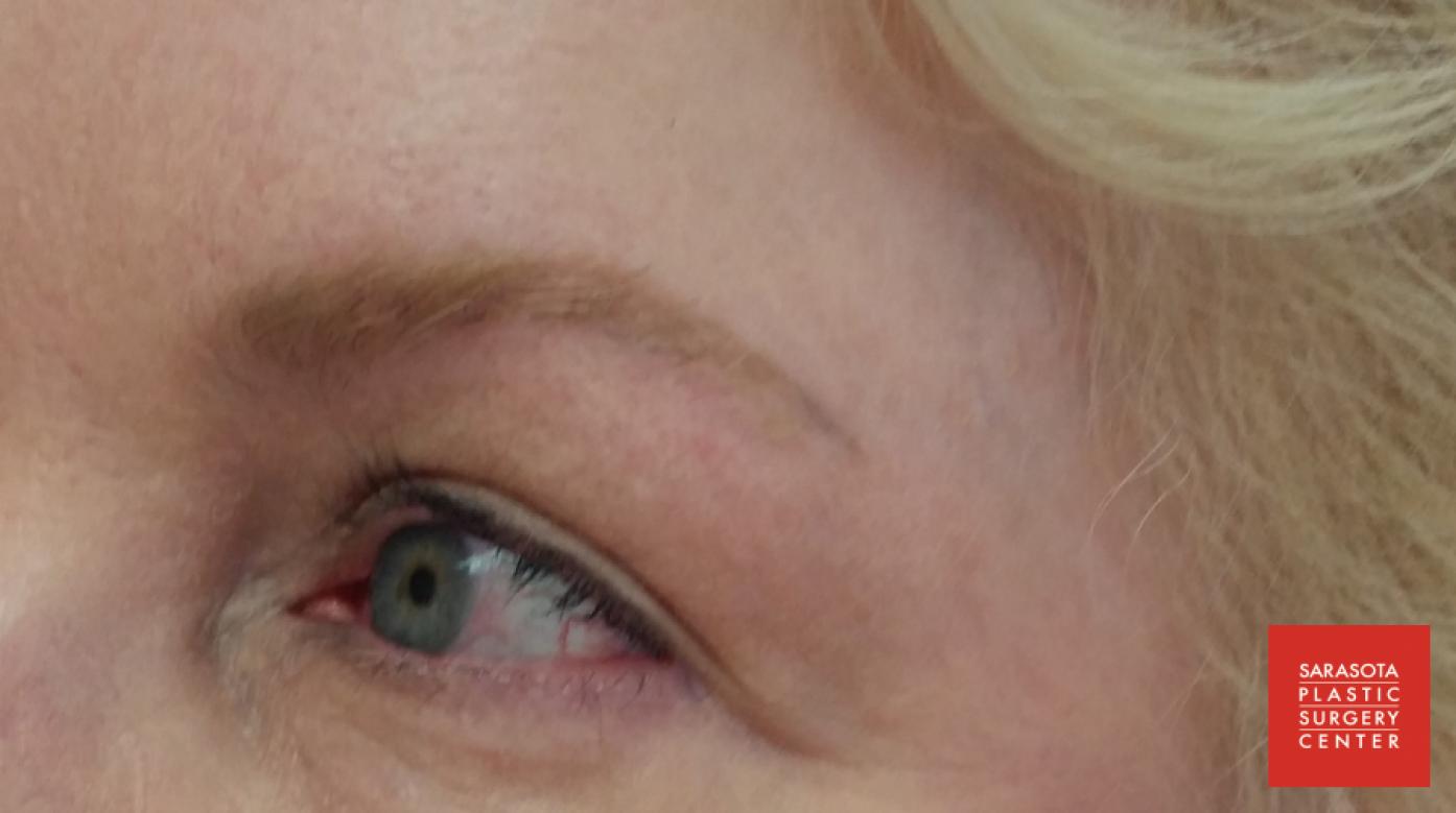 Permanent Makeup - Eyebrows: Patient 14 - After 