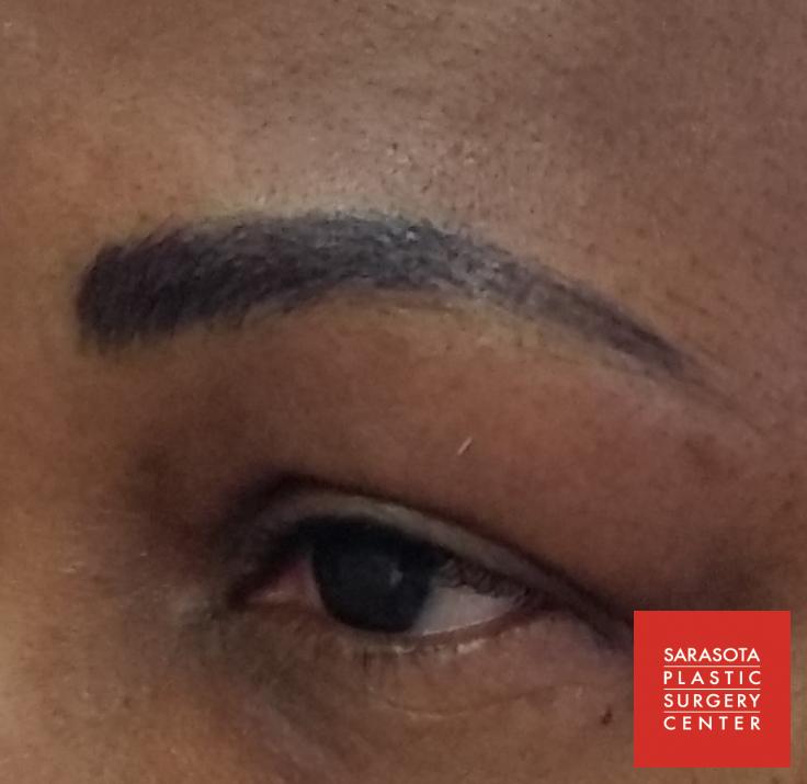 Permanent Makeup - Eyebrows: Patient 2 - After  