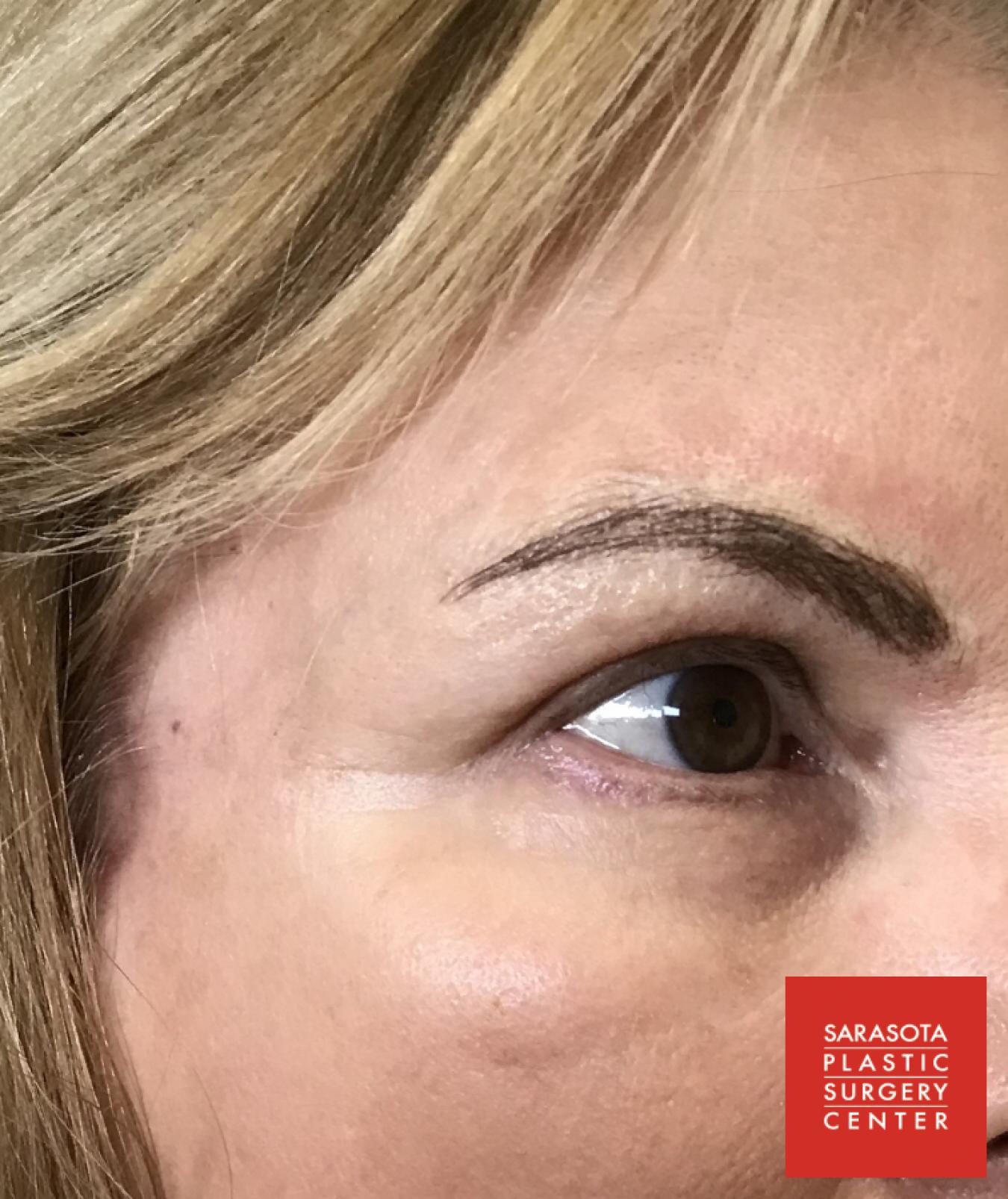 Permanent Makeup - Eyebrows: Patient 25 - After 