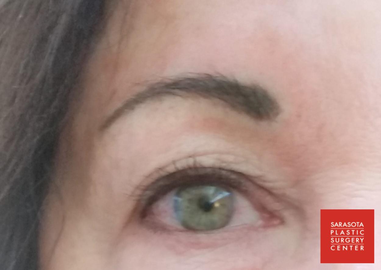 Permanent Makeup - Eyebrows: Patient 16 - After 