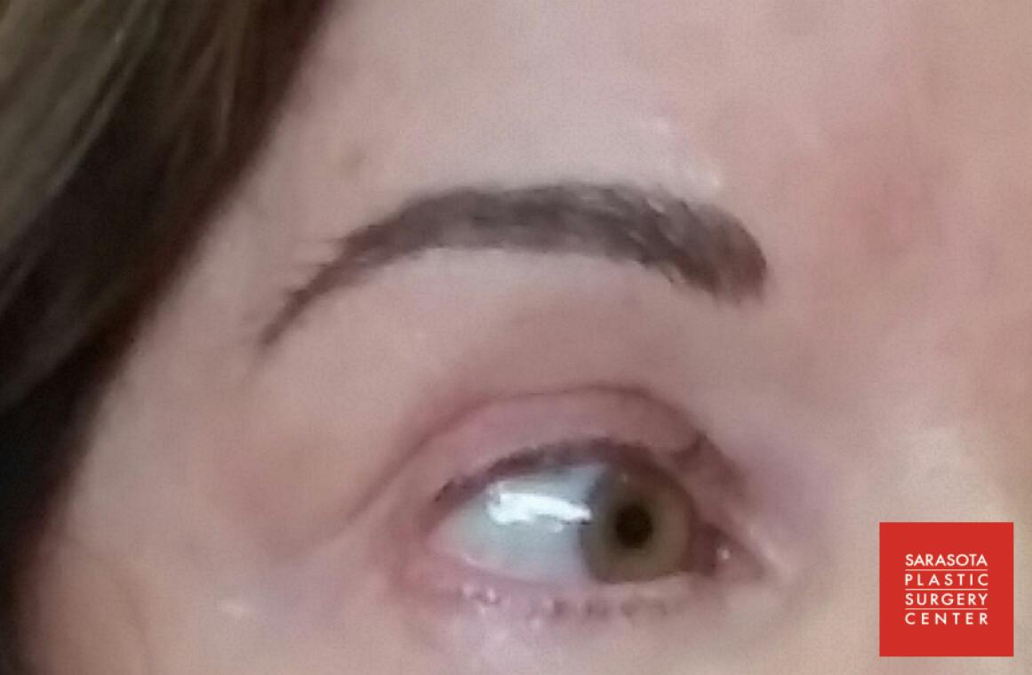 Permanent Makeup - Eyebrows: Patient 3 - After  