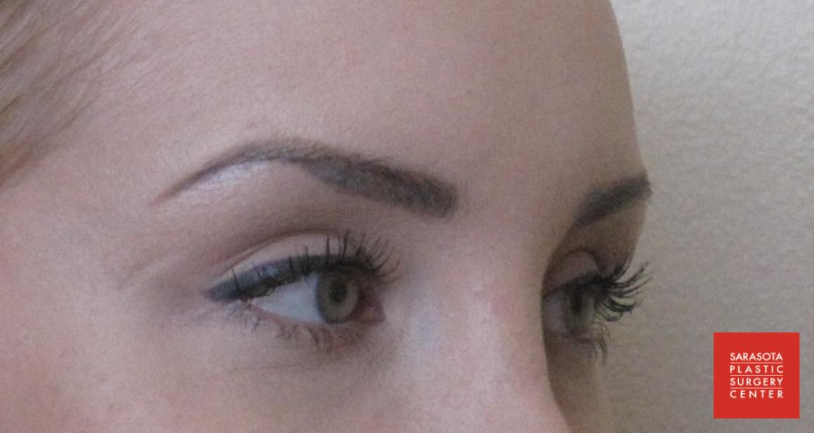 Permanent Makeup - Eyebrows: Patient 10 - After  