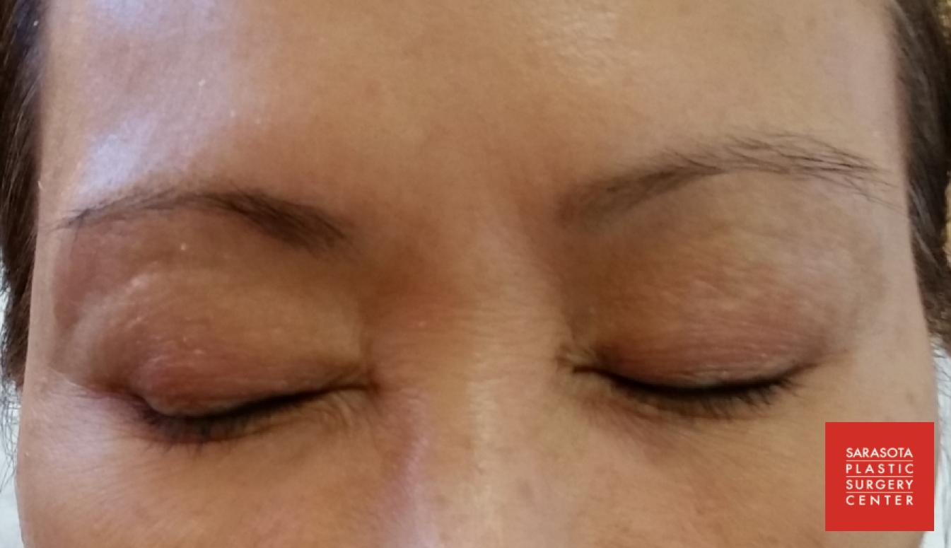 Permanent Makeup - Eyebrows: Patient 8 - After  