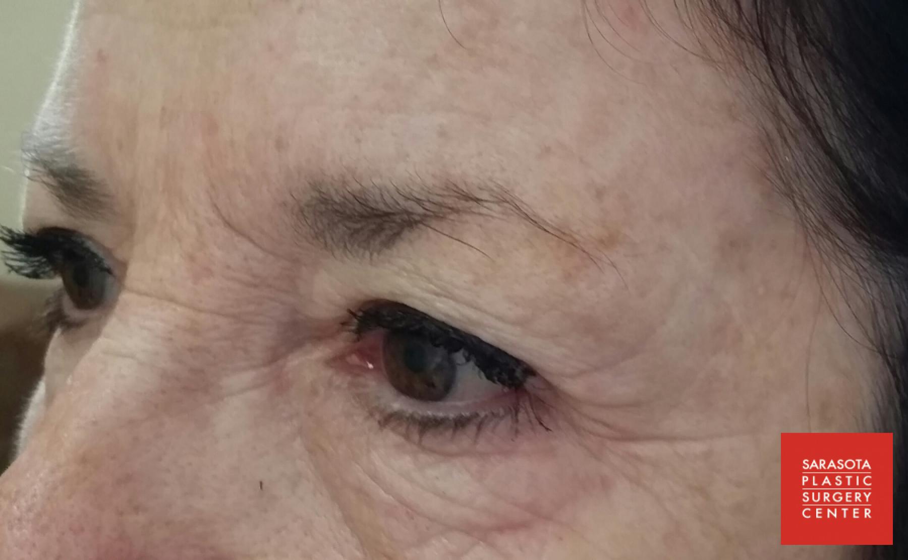 Permanent Makeup - Eyebrows: Patient 7 - After  