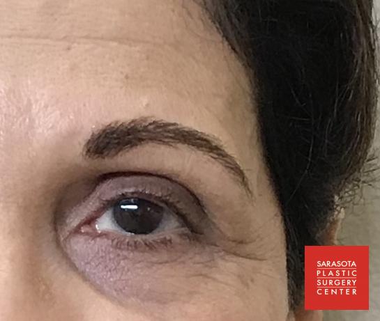 Permanent Makeup - Eyebrows: Patient 23 - After 