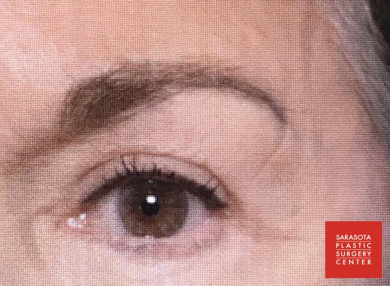 Permanent Makeup - Eyebrows: Patient 6 - After  