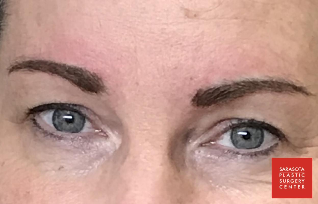 Permanent Makeup - Eyebrows: Patient 18 - After 