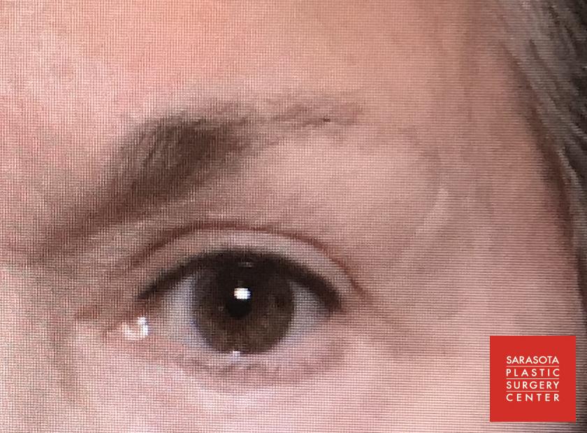 Permanent Makeup - Eyebrows: Patient 6 - After  