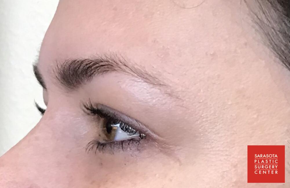 Permanent Makeup - Eyebrows: Patient 19 - Before 