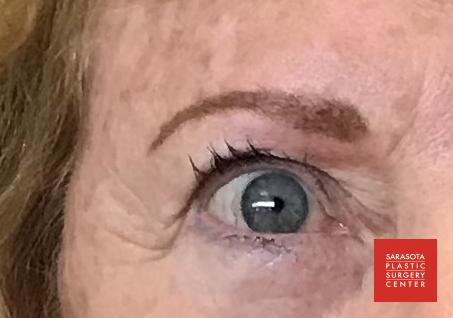 Permanent Makeup - Eyebrows: Patient 21 - After 