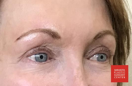 Permanent Makeup - Eyebrows: Patient 22 - After 