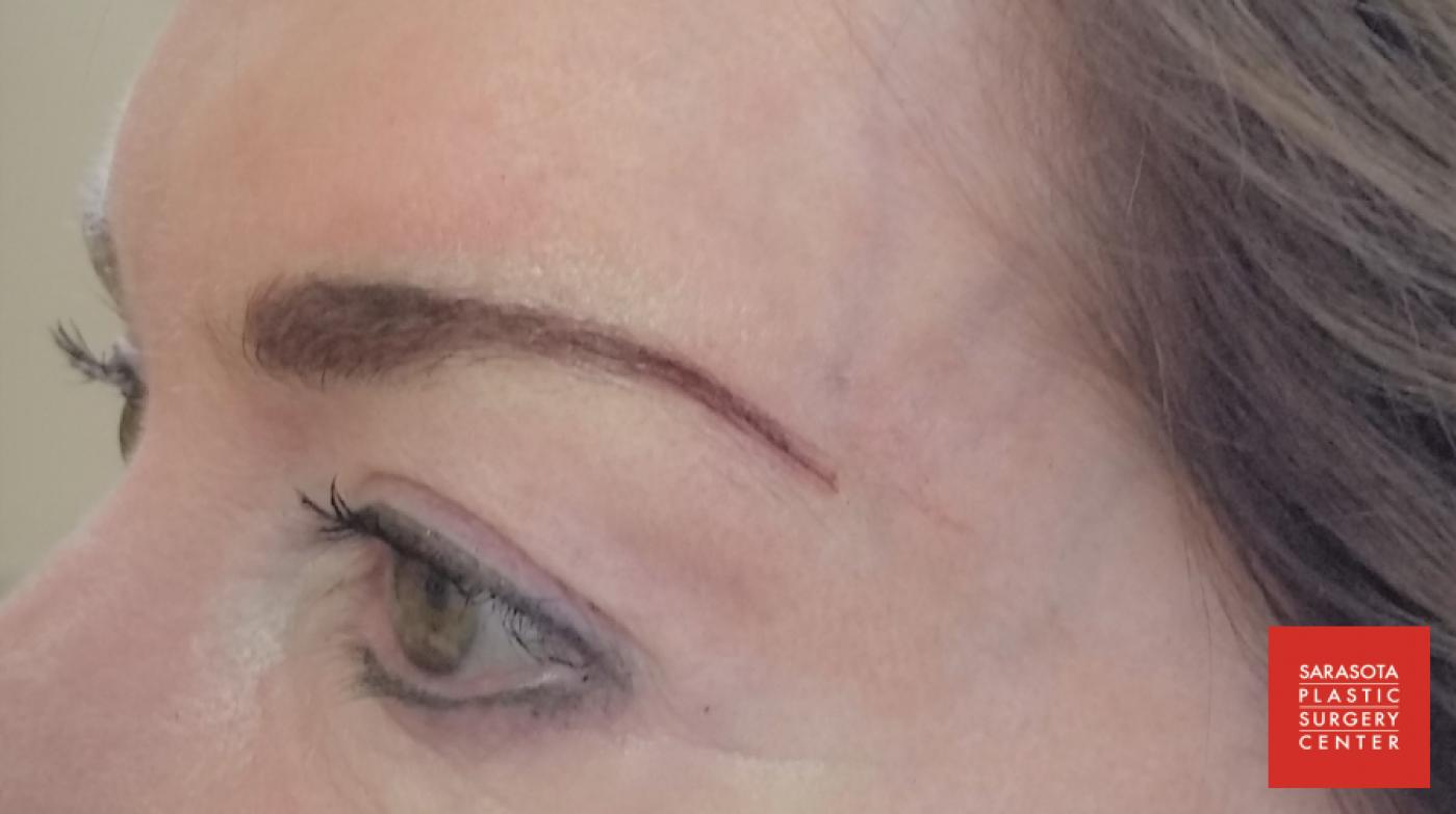 Permanent Makeup - Eyebrows: Patient 13 - After 