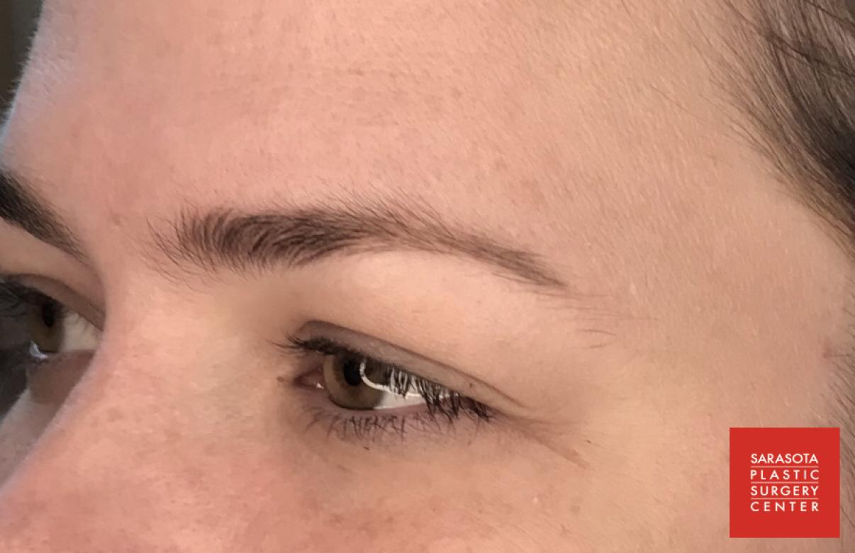 Permanent Makeup - Eyebrows: Patient 19 - After 