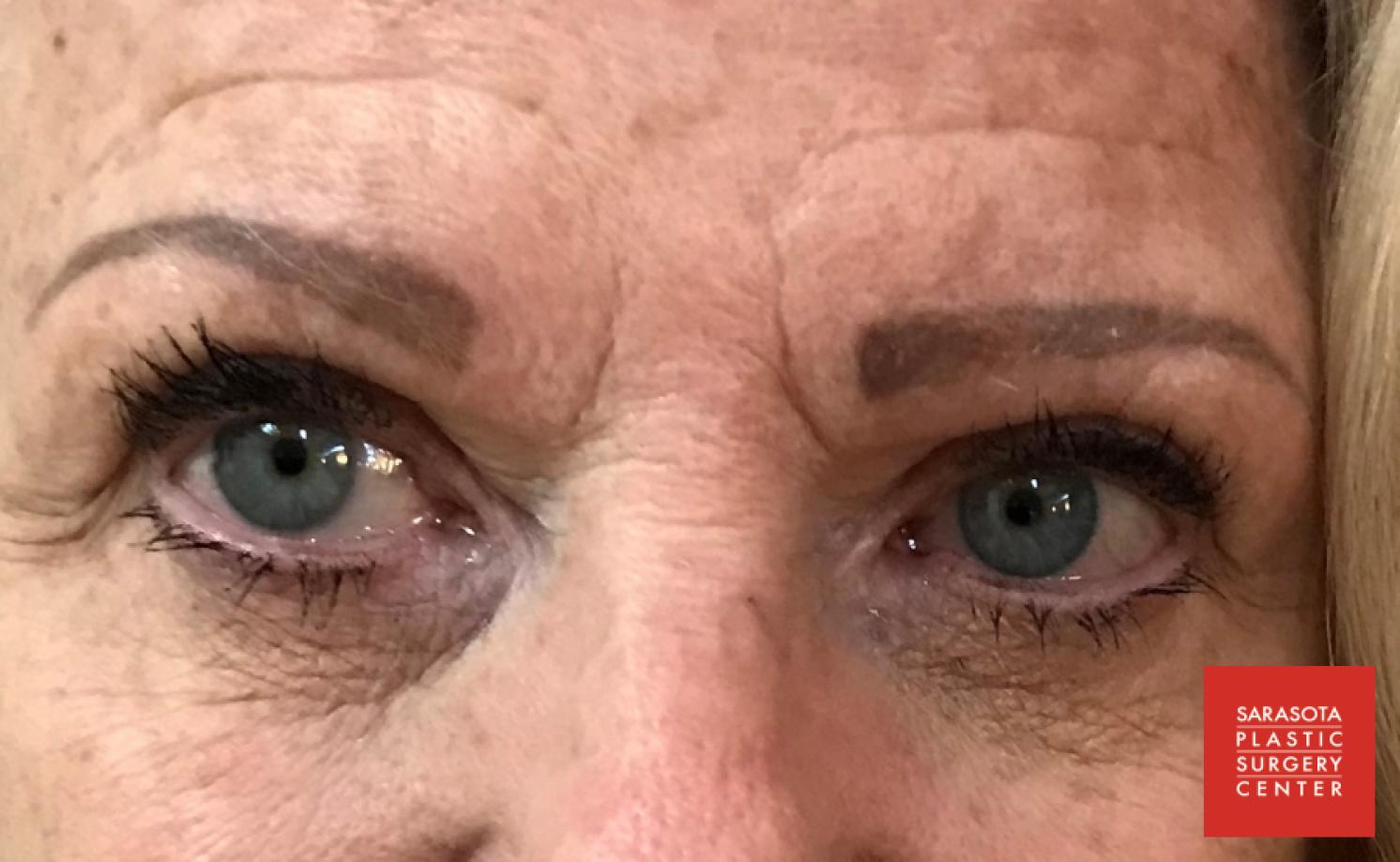 Permanent Makeup - Eyebrows: Patient 17 - After 