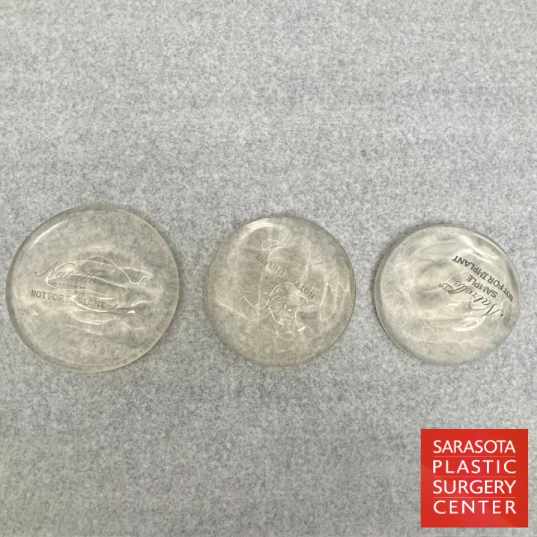 Breast Implant Profile: Patient 1 - Before and After  