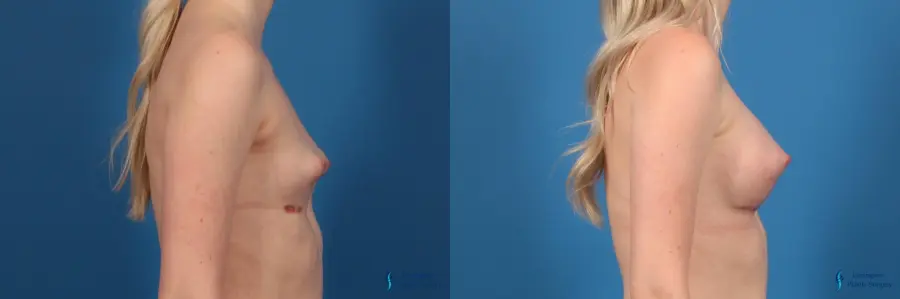 Plastic Surgery Before and After Photos
