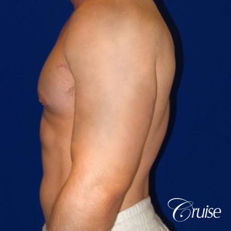 Pictures of young bodybuilder with puffy nipples - After Image 3