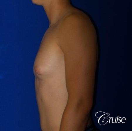 Before Image 5