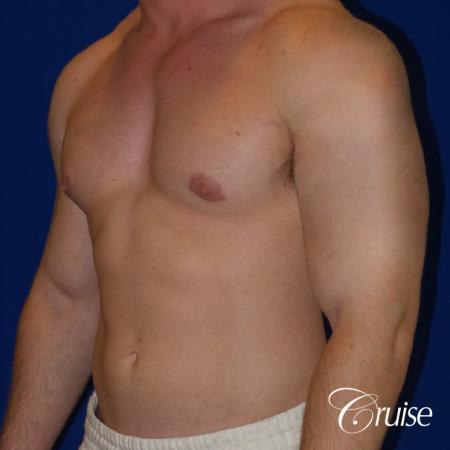 Pictures of young bodybuilder with puffy nipples - After Image 2