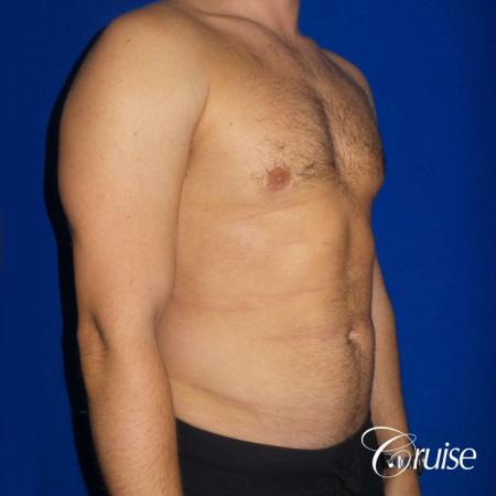 After Image 4