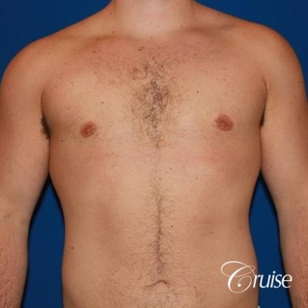 athletic adult with puffy nipple - After Image 1