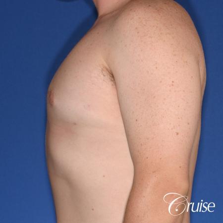 moderate gyne on teen with best pictures - After Image 2