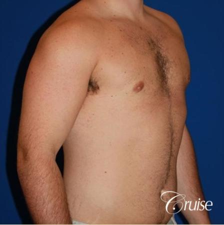 athletic adult with puffy nipple - After Image 3