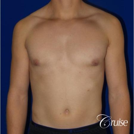 After Image 1