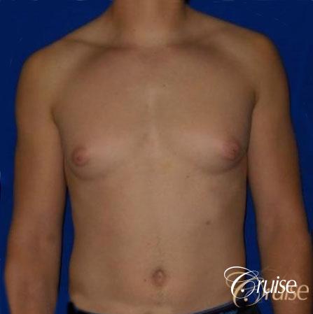 Before Image 1