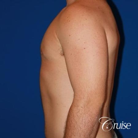 athletic adult with puffy nipple - After Image 2
