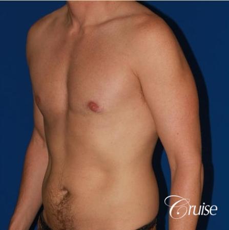 puffy nipple on low body fat - After Image 3