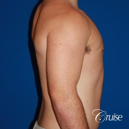 athletic adult with puffy nipple - After Image 4