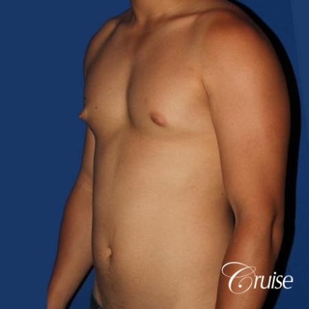 young athletic adult with puffy nipple - Before Image 2