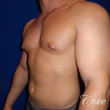 Pictures of young bodybuilder with puffy nipples - Before Image 2