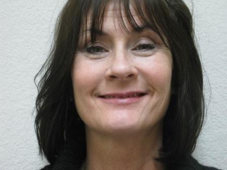 Lip Augmentation - Patient 2 - Before Image 6