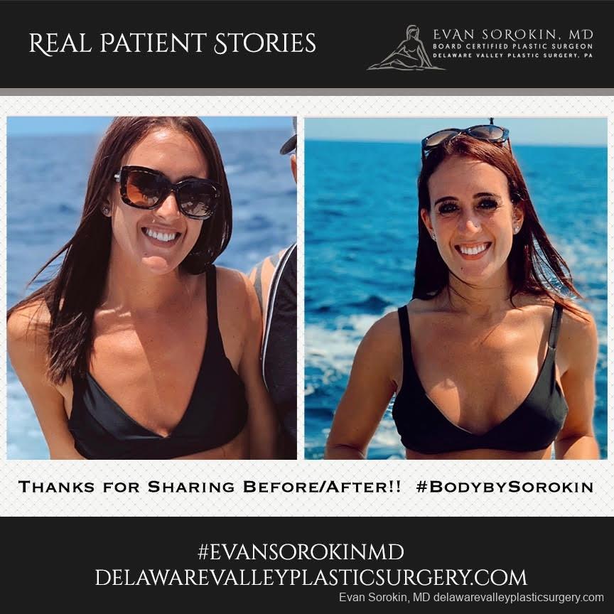 Real Patient Stories: Patient 18 - Before and After Image 1