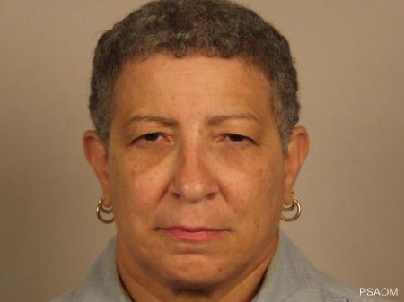 Eyelid Lift: Patient 1 - Before Image