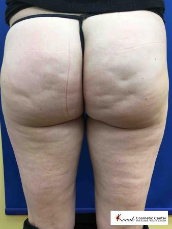 Case 232 - Before Image 1