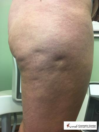 Case 137 - Before and After 3