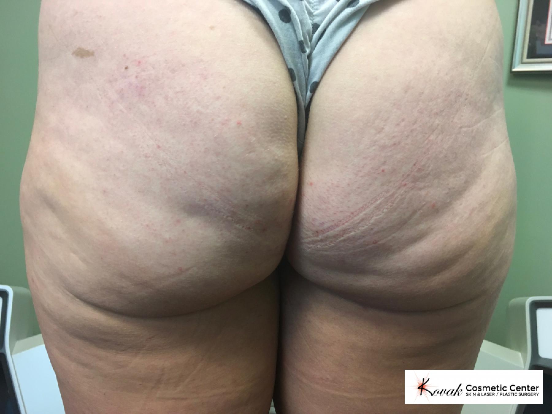 Case 123 - Before 
