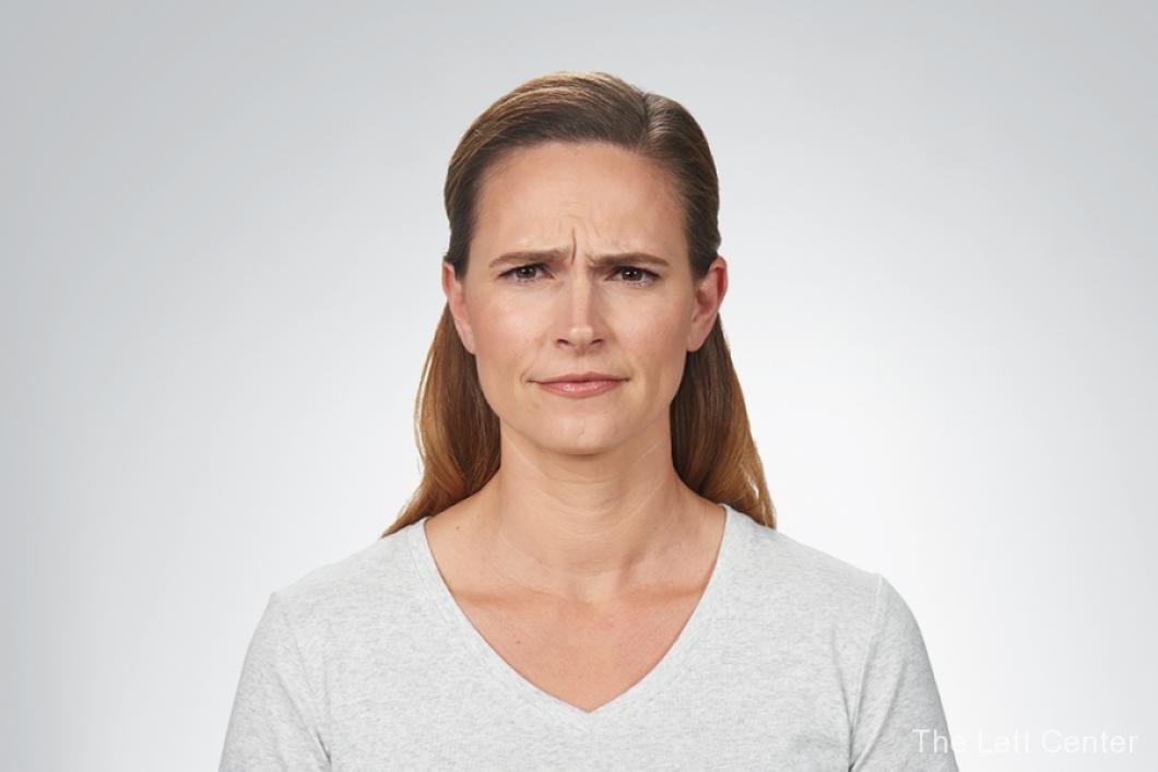 botox cosmetic injections before and after - Before