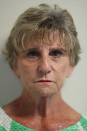 Facelift: Patient 4 - Before Image 1