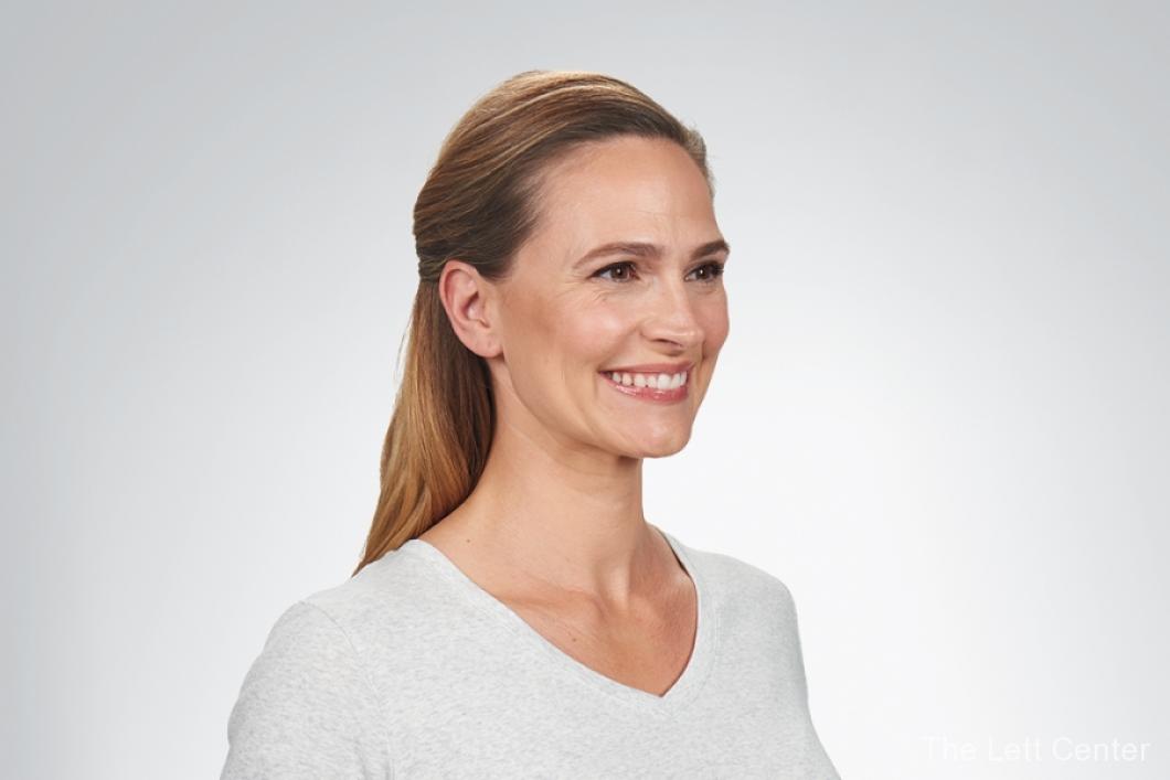 botox cosmetic injections before and after - Before and After 2