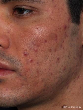 Scars Houston Tx