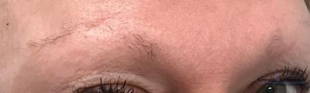 Microblading: Patient 3 - Before Image 1